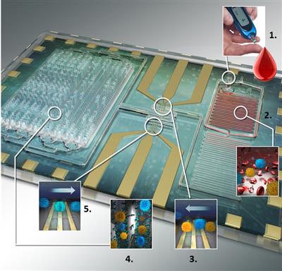 Differential immuno-capture biochip schematic: 1. Ten microliters of blood is infused into the biochip. 2. Erythrocytes were lysed and the leukocytes were preserved using as custom-made lysing and quenching buffers get mixed with blood. 3. The leukocytes pass over co-planar platinum microfabricated electrodes and are counted. 4. Specific cell antibodies e.g. monoclonal CD4 T cell antibody is initially adsorbed on the capture chamber. CD4 T cells get captured as they interact with the antibodies in the chamber. 5. Remaining leukocytes gets counted again with second counter. The difference in the respective cell counts give the concentration of the cells captured.
