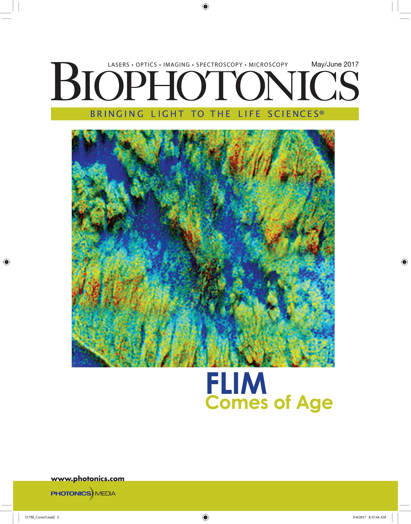 FLIM delivers intracellular images based on differences