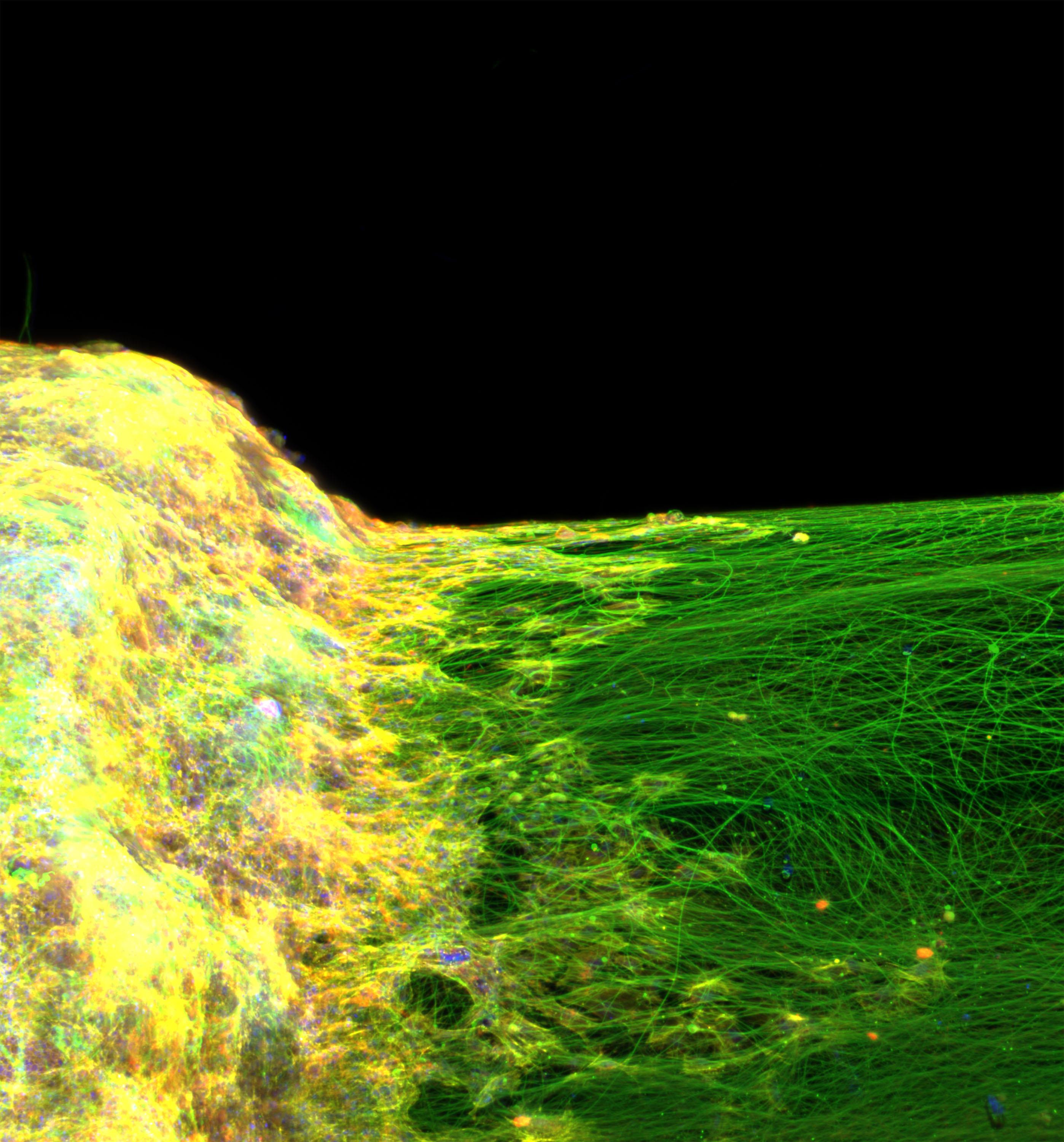 One of the advantages of this biofabrication method is that the tissues can be incorporated to platforms that would have been otherwise too difficult. Here, a ring-shaped neural tissue mimic was installed onto a cylindrical glass rod, and the image shows how dense neural extensions are able to form on this substrate due to the geometrical advantage of the tissue.