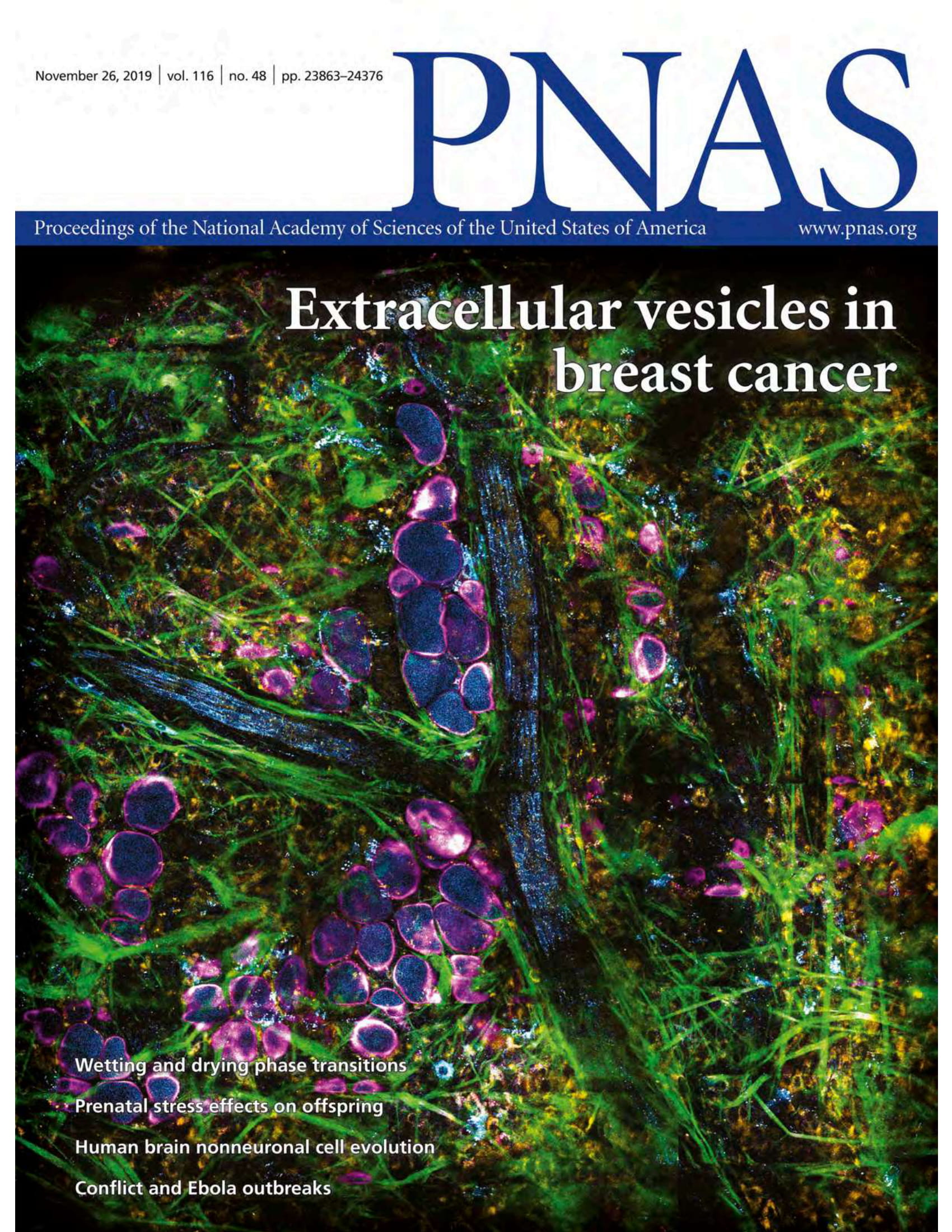 Label-free visualization and characterization of extracellular vesicles in breast cancer