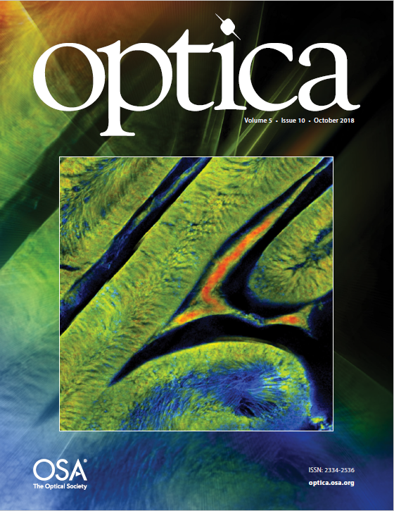 High-speed imaging of transient metabolic dynamics using two-photon fluorescence lifetime imaging microscopy