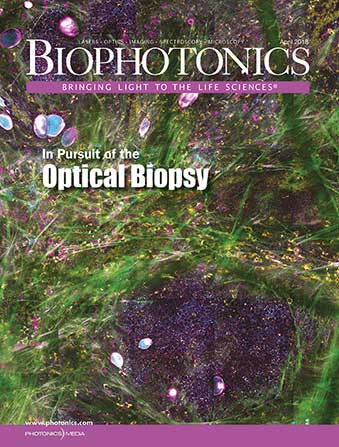 Optical biopsies can transform pathology. Photonics Media