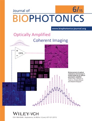 Enhancement of optical coherence microscopy in turbid media by an optical parametric amplifier