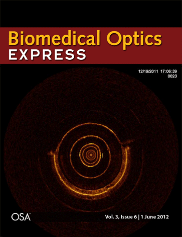 Real-time three-dimensional optical coherence tomography image-guided core-needle biopsy system