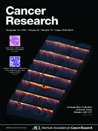 Intraoperative evaluation of breast tumor margins with optical coherence tomography