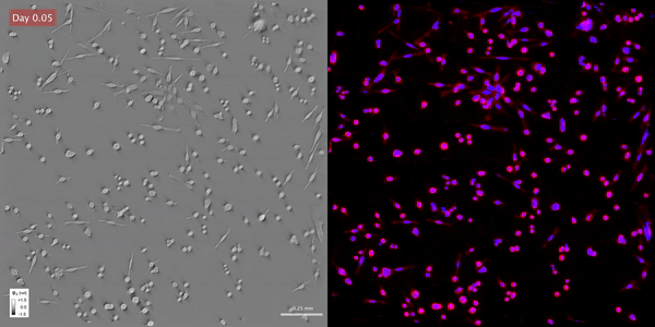Time-lapse gradient light interference microscopy, or GLIM, left, and phase imaging with computational specificity imaged over seven days.