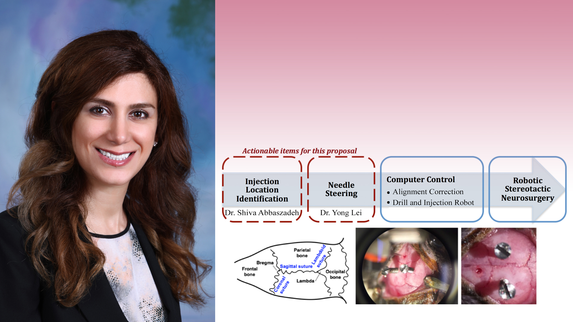 Abbaszadeh's imaging work aims at assisting robotic neurosurgery