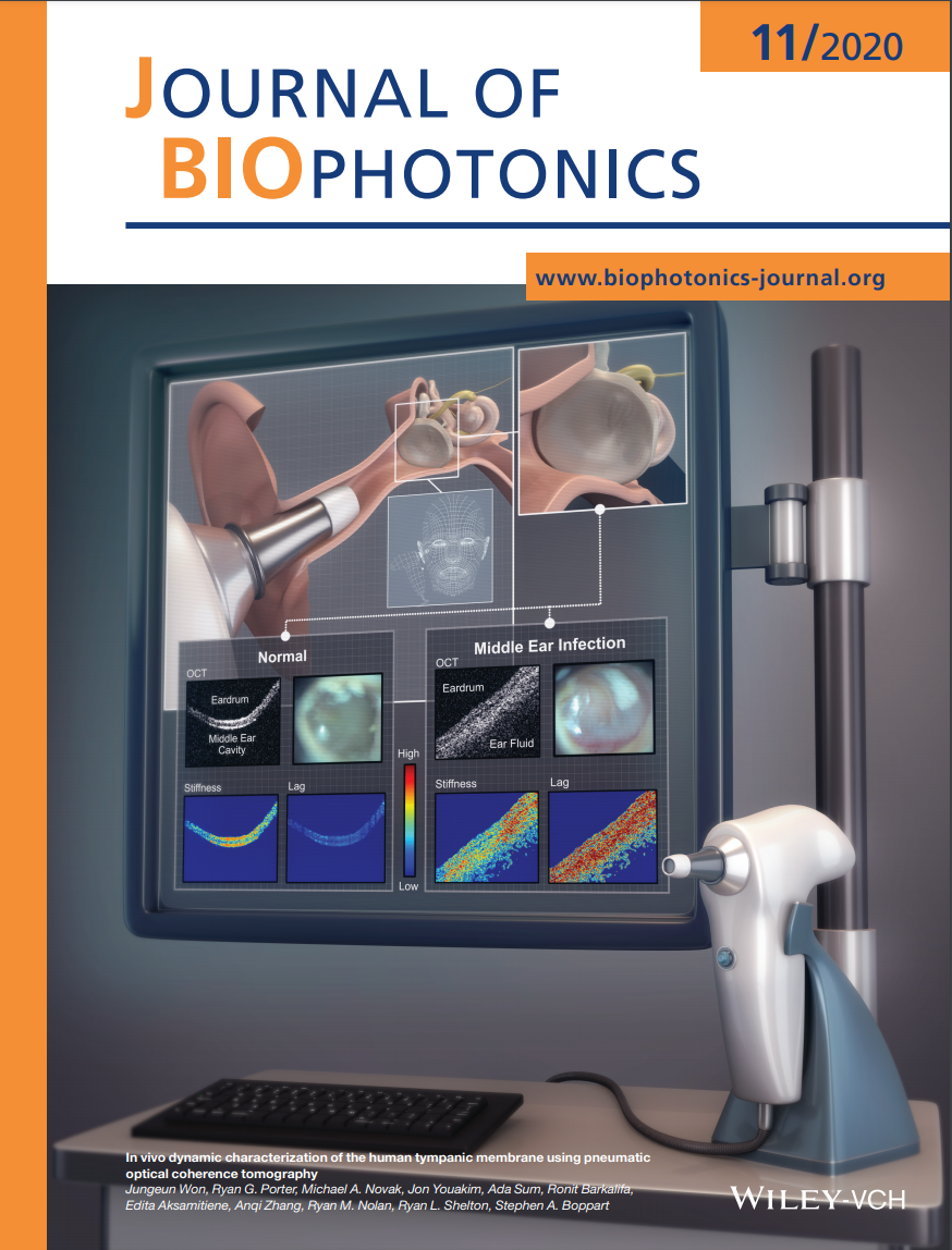 In vivo dynamic characterization of the human tympanic membrane using pneumatic optical coherence tomography.  (Invited cover figure)